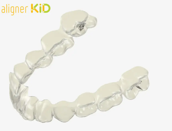 image illustrant un aligneur kid